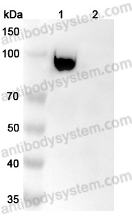 Anti-Human FAP/FAPalpha Antibody (SAA2014)